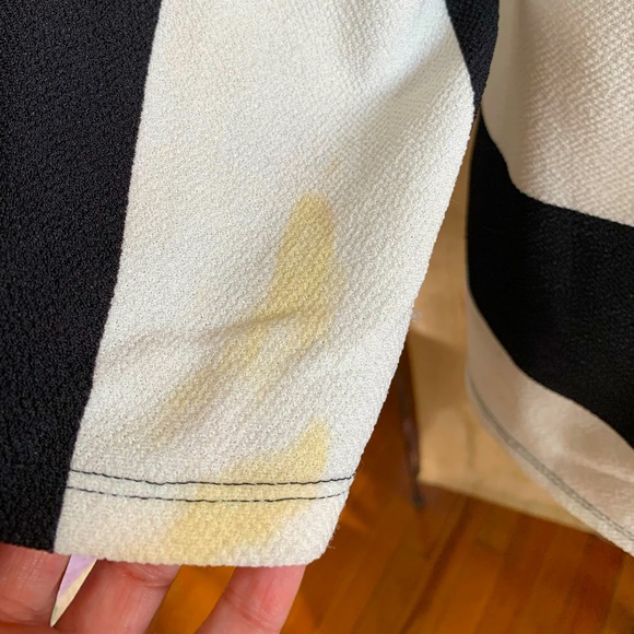 Chico’s Peplum Top- Black and White - Picture 6 of 10